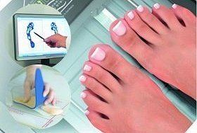 Как делают индивидуальные ортопедические стельки